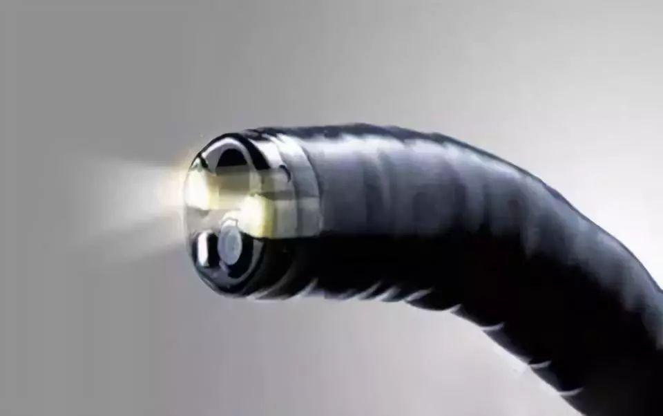 做胃镜是不是要多久做一次,胃镜才做一年半有必要再做吗