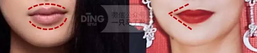 整牙都有哪些改变,整牙变美的一定要注意的6点