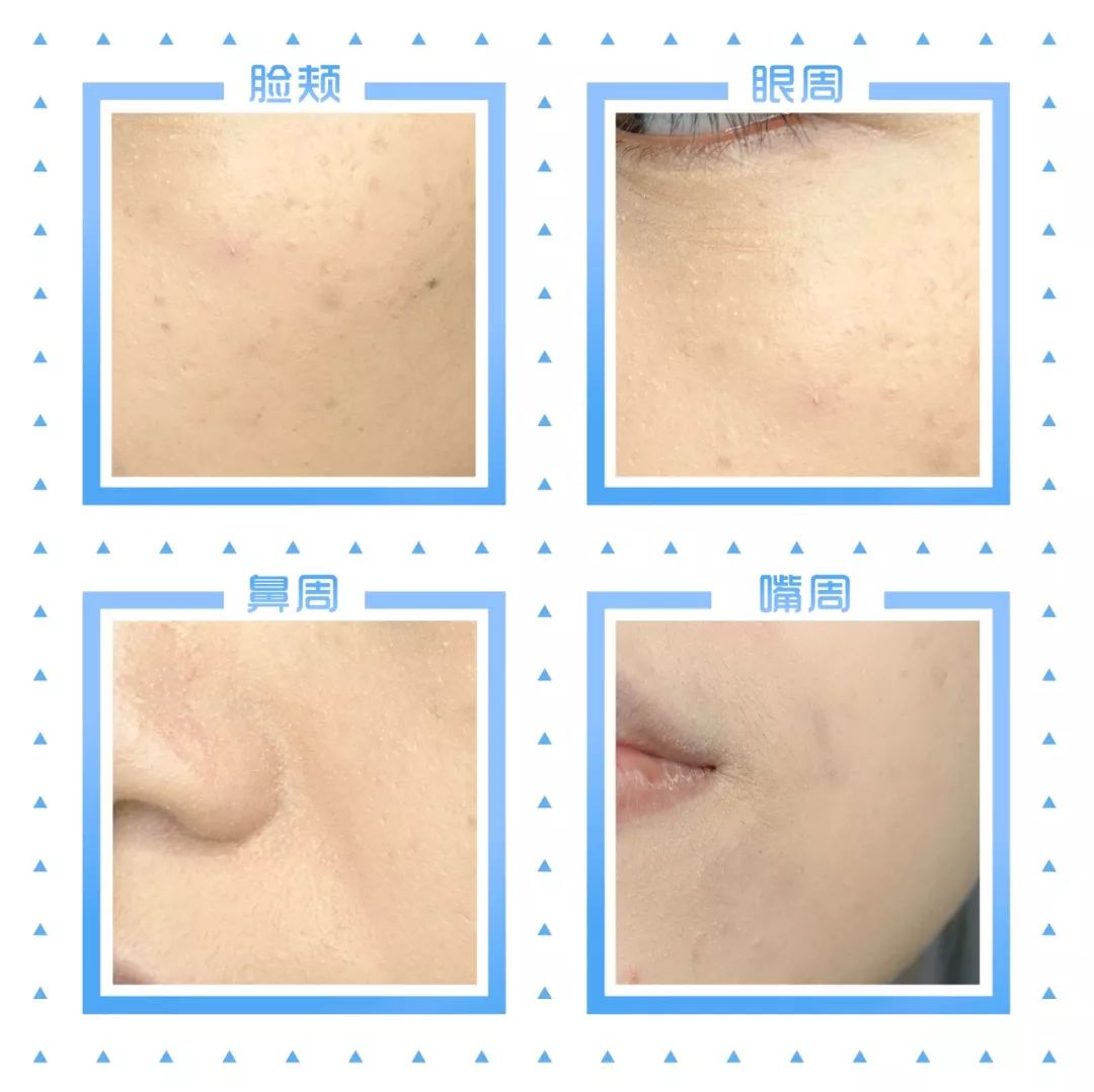 「Foundation101」遮瑕组在线battle!谁才是水煮蛋之王？（上）