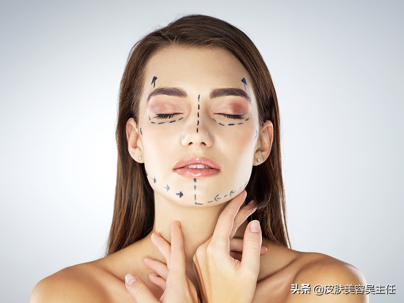 线雕的线到底会不会吸收,线雕的线往下滑怎么办