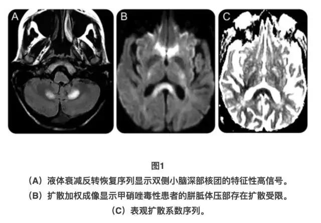 头孢类抗生素脑病,头孢类抗生素可引起脑病吗