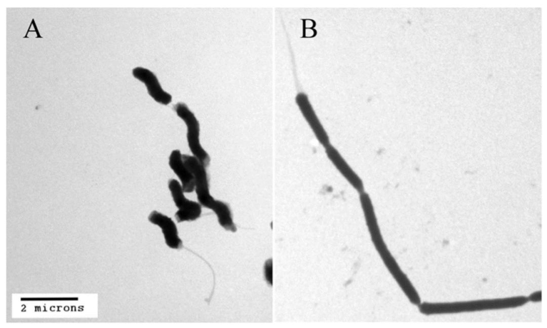 幽门螺旋杆菌胃病吃什么可根除,幽门螺旋杆菌阳性中医怎么调养