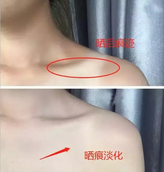 泰国防晒界“黑马”出击，每天一喷，28天白成一道光，越晒越美丽