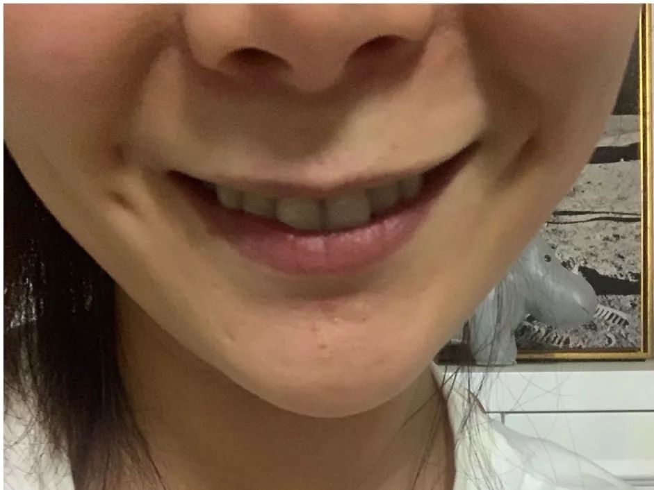 错过青春又如何,错过生长发育期怎么办