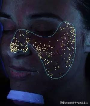 visia皮肤检测仪,visia皮肤检测报告数值越大越好吗