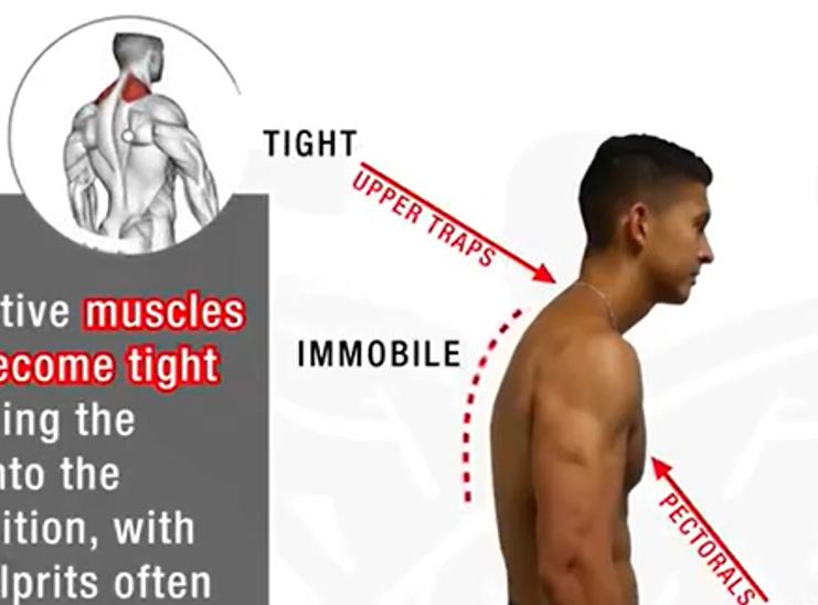 有效改善体态,提升气质减肥瘦全身方法