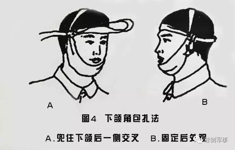 军队三角巾包扎法视频,部队卫生与救护三角巾包扎方法