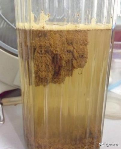 健康*男处**拉的一坨屎，能卖300块