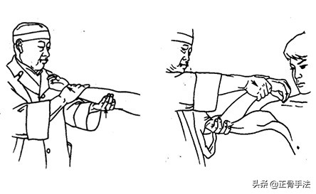骨错则筋挪,关节脱位引起筋肉损伤时,4种整骨手法帮您复位