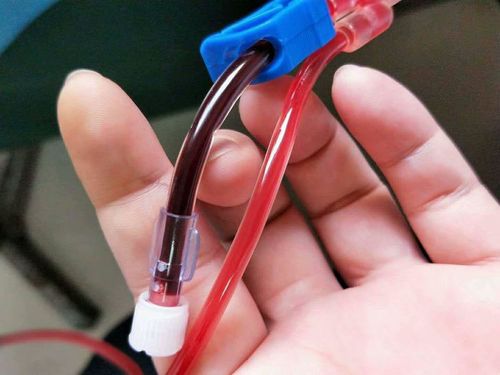 吃降尿酸药怎样防止痛风发作,有什么新药降尿酸