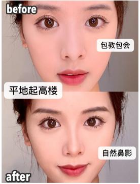 女生脸上常见的问题,女生脸上皮肤差如何改善