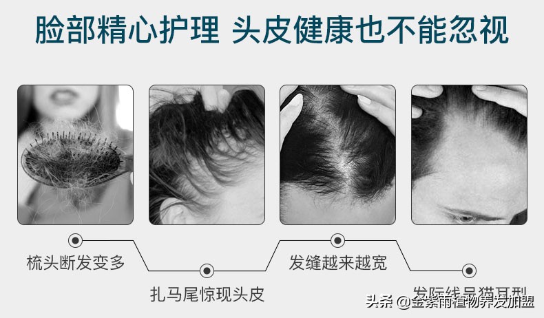 金紫雨养发馆加盟官方网站,养发馆经营技巧和方法有哪些