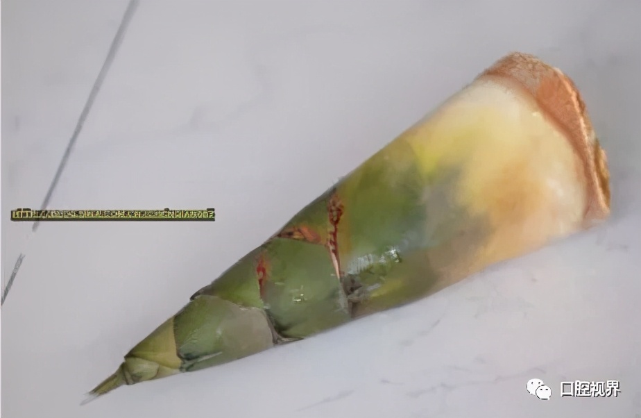 鑱婅亰鎷旂墮鐨勯偅浜涗簨鍎挎湳鍚庢仮澶嶇瘒,30骞存嫈鐗欏疄鎴樼粡楠屽垎浜嫈鐗欑柤涓嶇柤