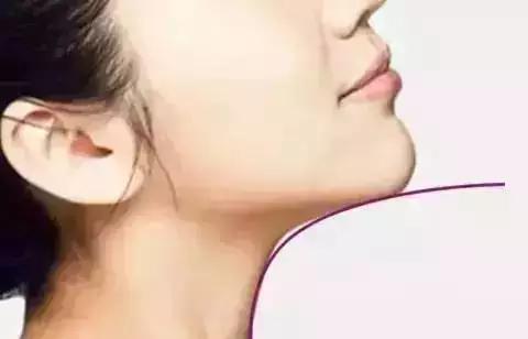 隆下巴后,整张脸都会变美了