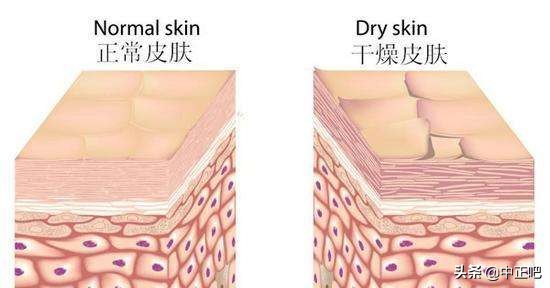 秋冬季节皮肤干燥发痒怎么办,秋冬皮肤干裂涂什么