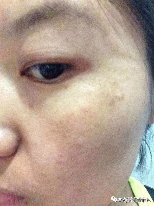 斑点暗黄肌最全的改善小技巧,都在这里