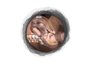 剖腹产宝宝自己从肚子里爬出来？分娩的时候宝宝和你一起在努力