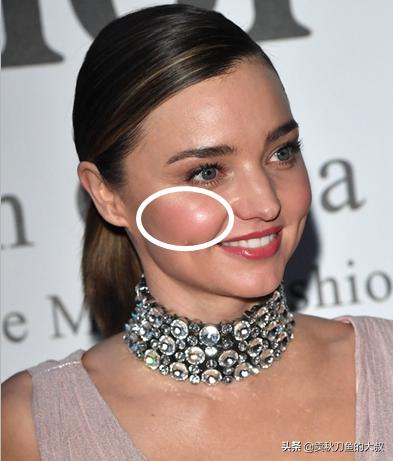 尖脸变圆脸方法,大脸最快变小脸的方法