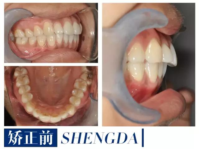 山西“爱马仕”级别齿科医院!get明星同款笑容