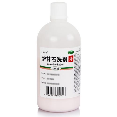 蚊虫叮咬过敏越来越严重了怎么办,蚊虫叮咬过敏症状中药