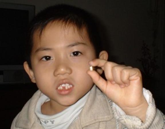 孩子换牙掉的牙怎么处理,孩子换牙掉了怎么处理最好