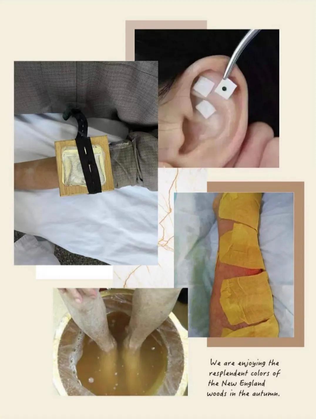 雷火灸适用于哪些疾病,雷火灸神器家用全身灸