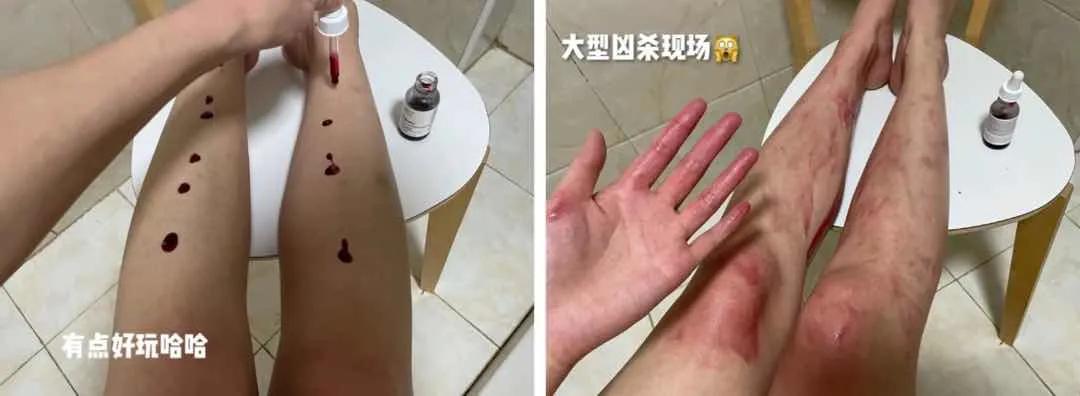 夏天露肉的季节,露肉的正确美白方法