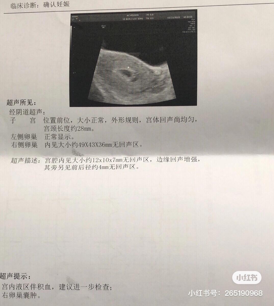 怀孕41天孕酮低于15不建议保胎,孕酮低42天没看到胚芽