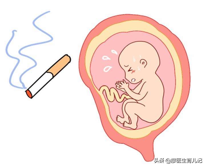 胎停有什么征兆应该如何预防胎停,胎停人工流产后注意事项和调理