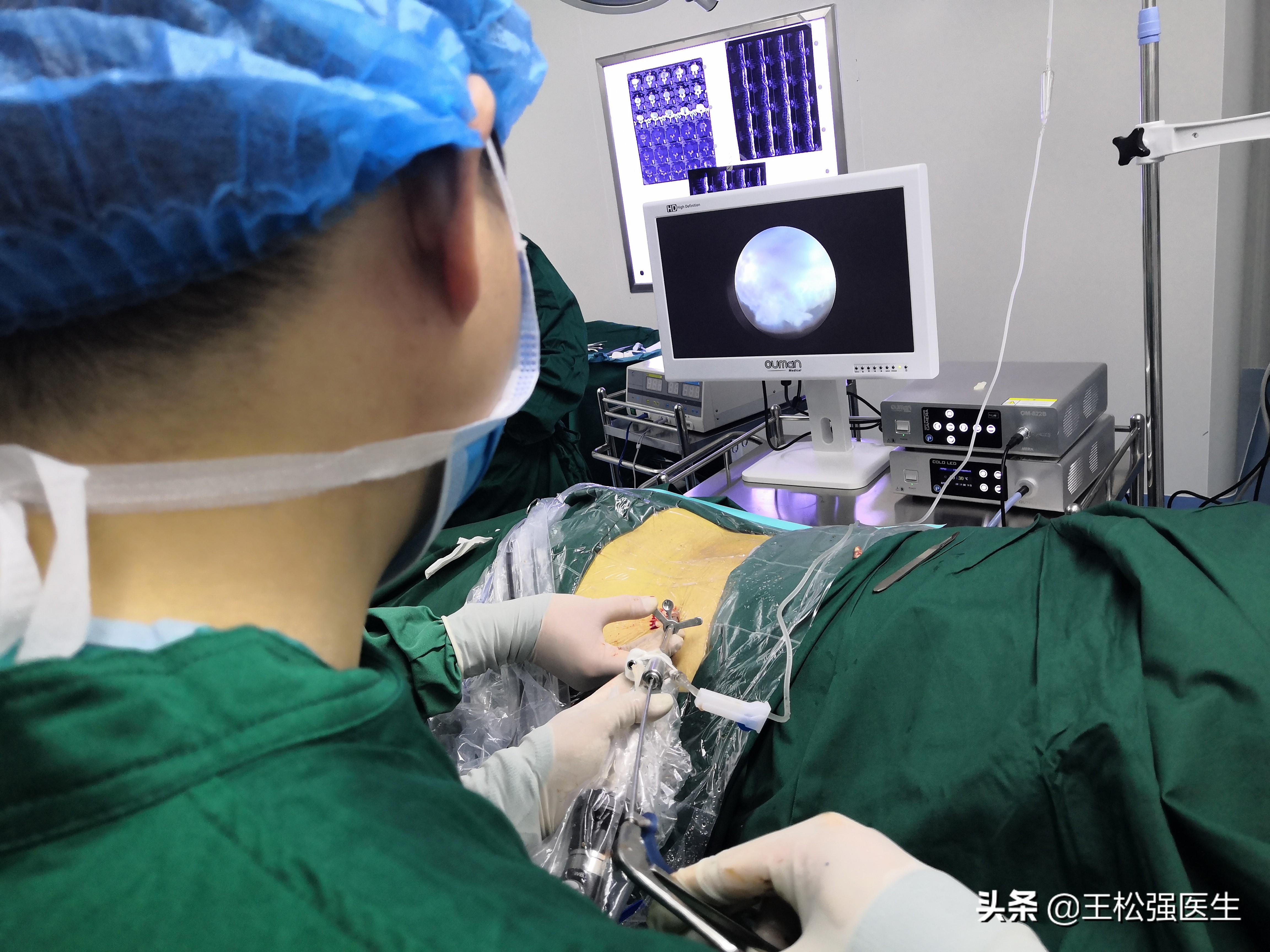 椎间孔镜术后注意的地方,椎间孔镜术后注意哪些事项