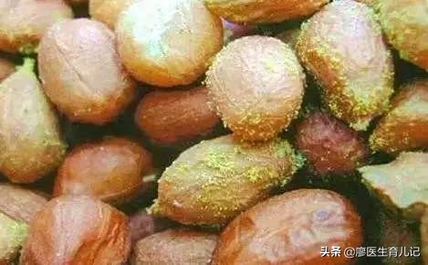 黄曲霉素中毒一般会死人吗,黄曲霉毒素产生的条件