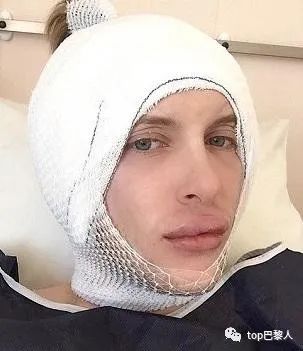 法国情侣豪掷200万，经历15次手术，只为成芭比与肯尼