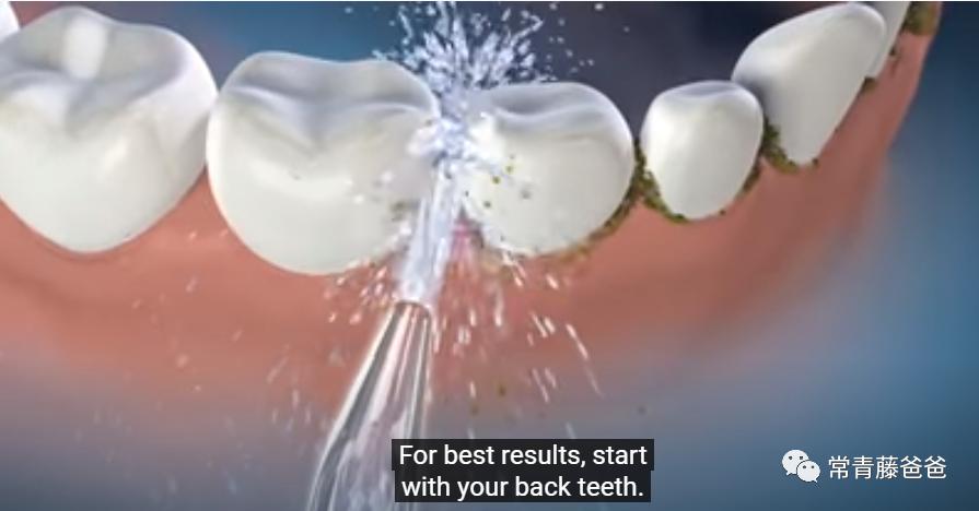 孩子有了龋齿刷牙还有用吗,用牙线清理牙缝很臭是蛀牙吗