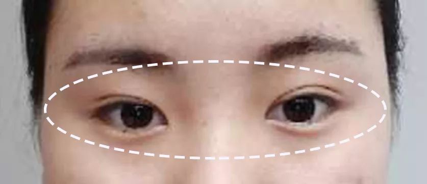 求改善痘痘真实办法,想改变脸上痘痘