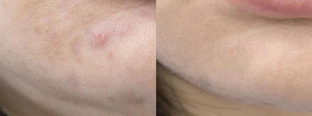 双11捡漏,最后捡漏144万元