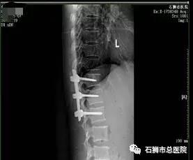 石狮市骨科医院,石狮市总医院骨科多少钱