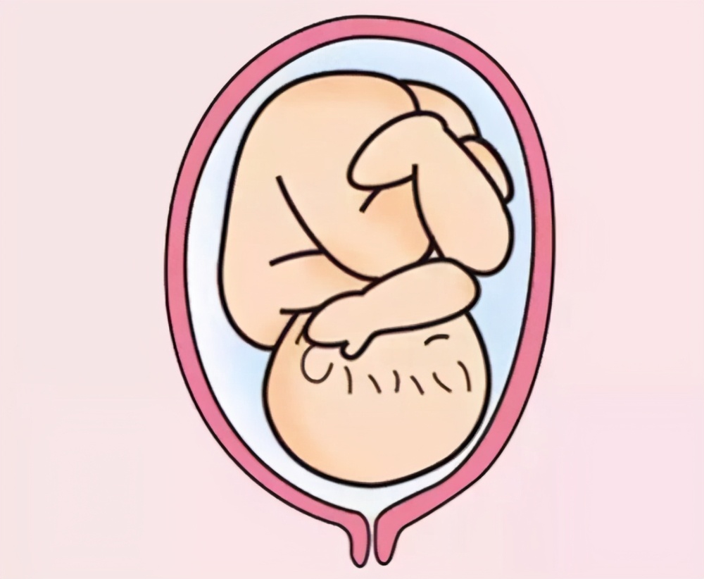 顺生胎儿双顶径多少,双顶径是哪个指标