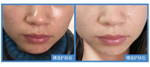 皮肤不吸收保养品,皮肤不吸收护肤品是什么样的