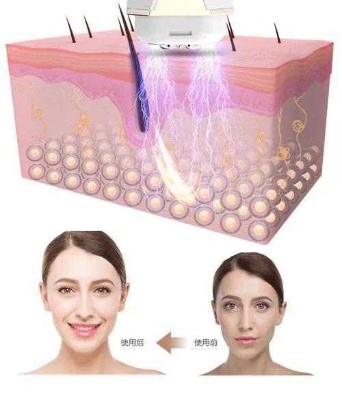 李佳琦推荐的提拉紧致美容仪,提拉紧致抗衰美容仪李佳琦