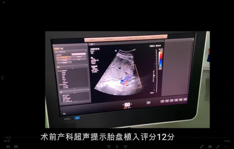 38岁女子四次剖宫产胎盘嵌入子宫术中出血3500毫升哈医大一院产科抢救团队力保高危孕妇母子平安