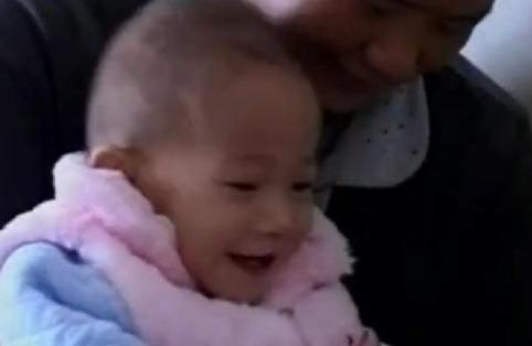 1岁半女童身怀9斤“胎儿”,手术医生刚打开肚子:自己就跳出来了