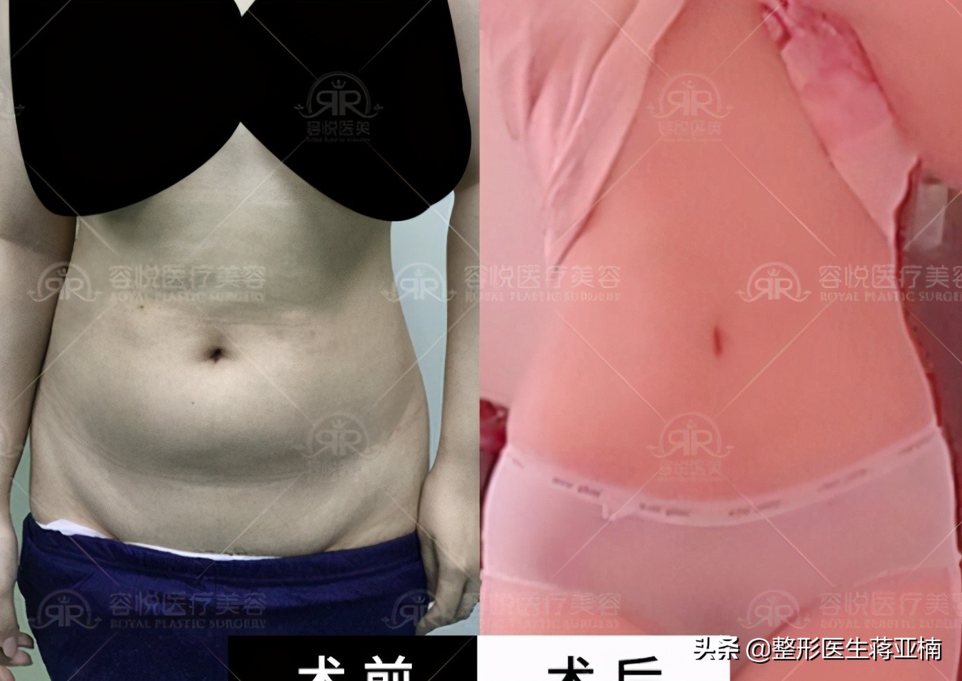 一次性说清,一次性说清要求