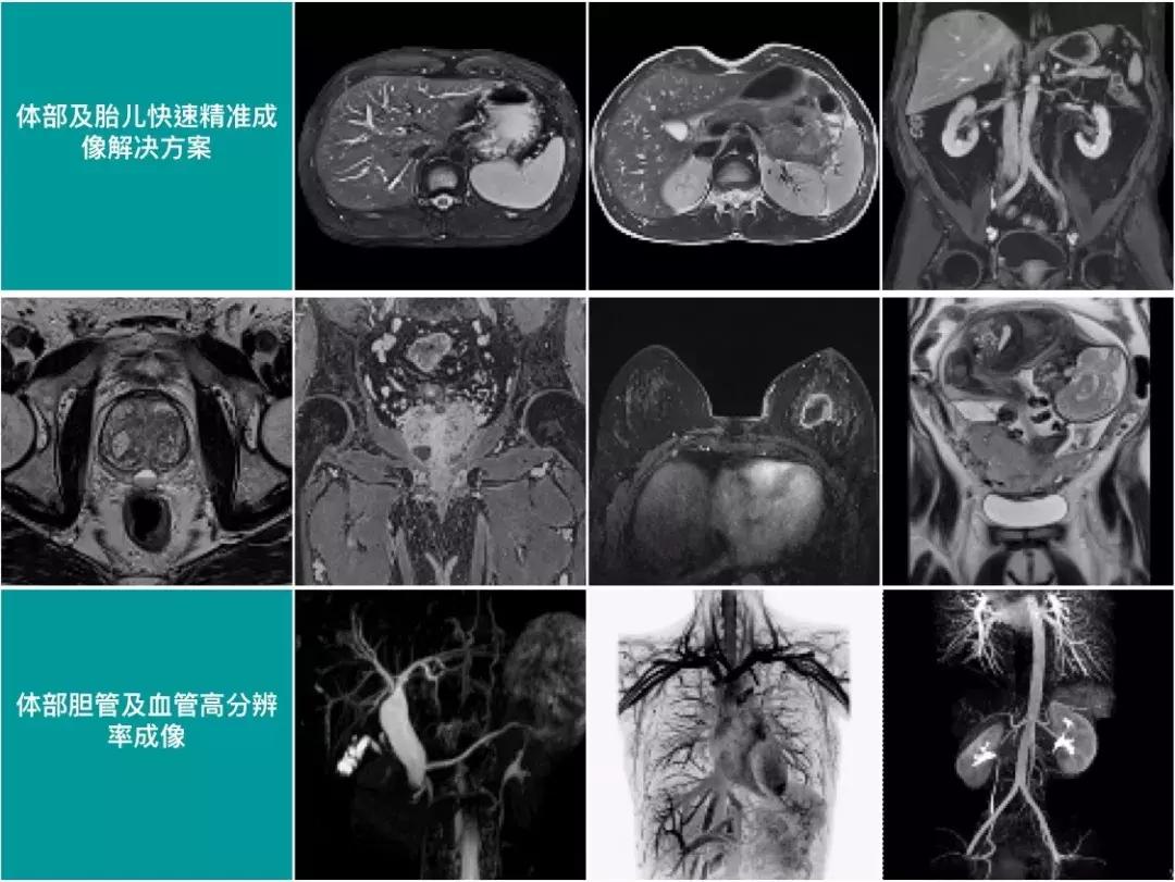 九江市第一人民医院开发区分院西门子1.5T超导磁共振正试运行
