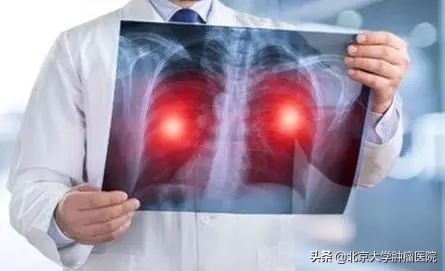 夫妻一方患了肺癌会传染吗,肺癌患者的口水会不会传染肺癌