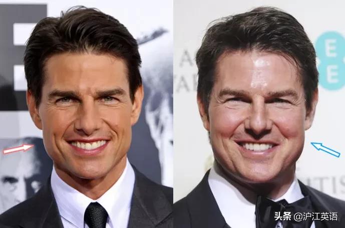 阿汤哥年轻时盛世美颜,阿汤哥整容失败