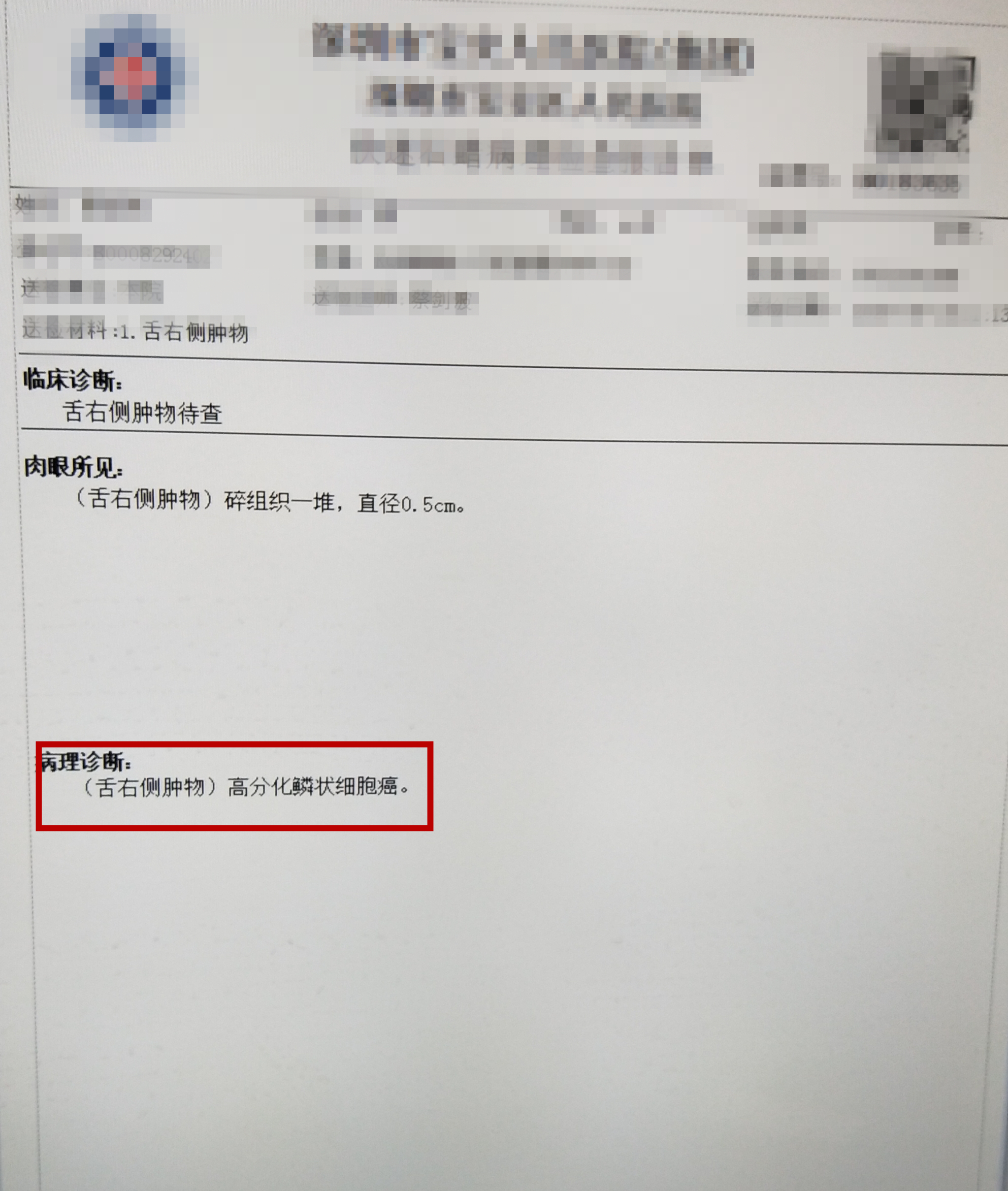吃槟榔是需要削骨吗,吃槟榔用剥皮吗