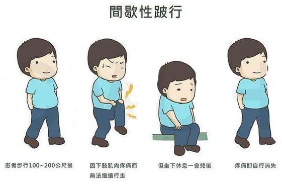 腰椎间盘突出我们应该怎么更好的治疗