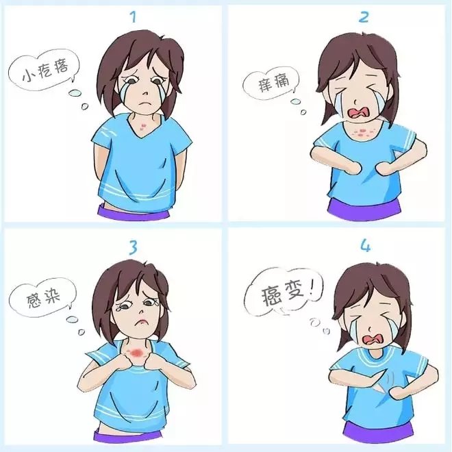 夏天疤痕治疗怎么做,多年疤痕秋冬疤痕痒怎么消除