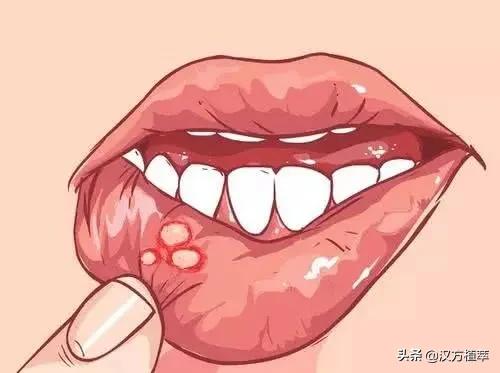 很多人都会上火吗,会不会有人经常上火