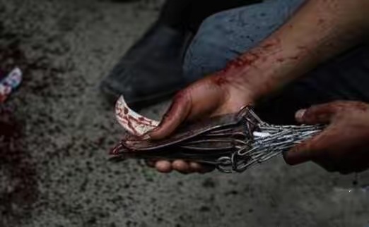 她4岁被*暴强**，5岁被割生殖器，13岁嫁60岁老头，22岁时惊艳世界